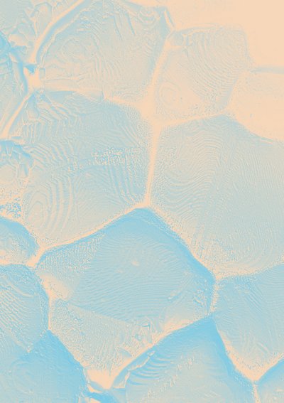 sonoscopic morphologies sonoscopic morphologies